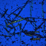 Asbestiform tremolite fibres