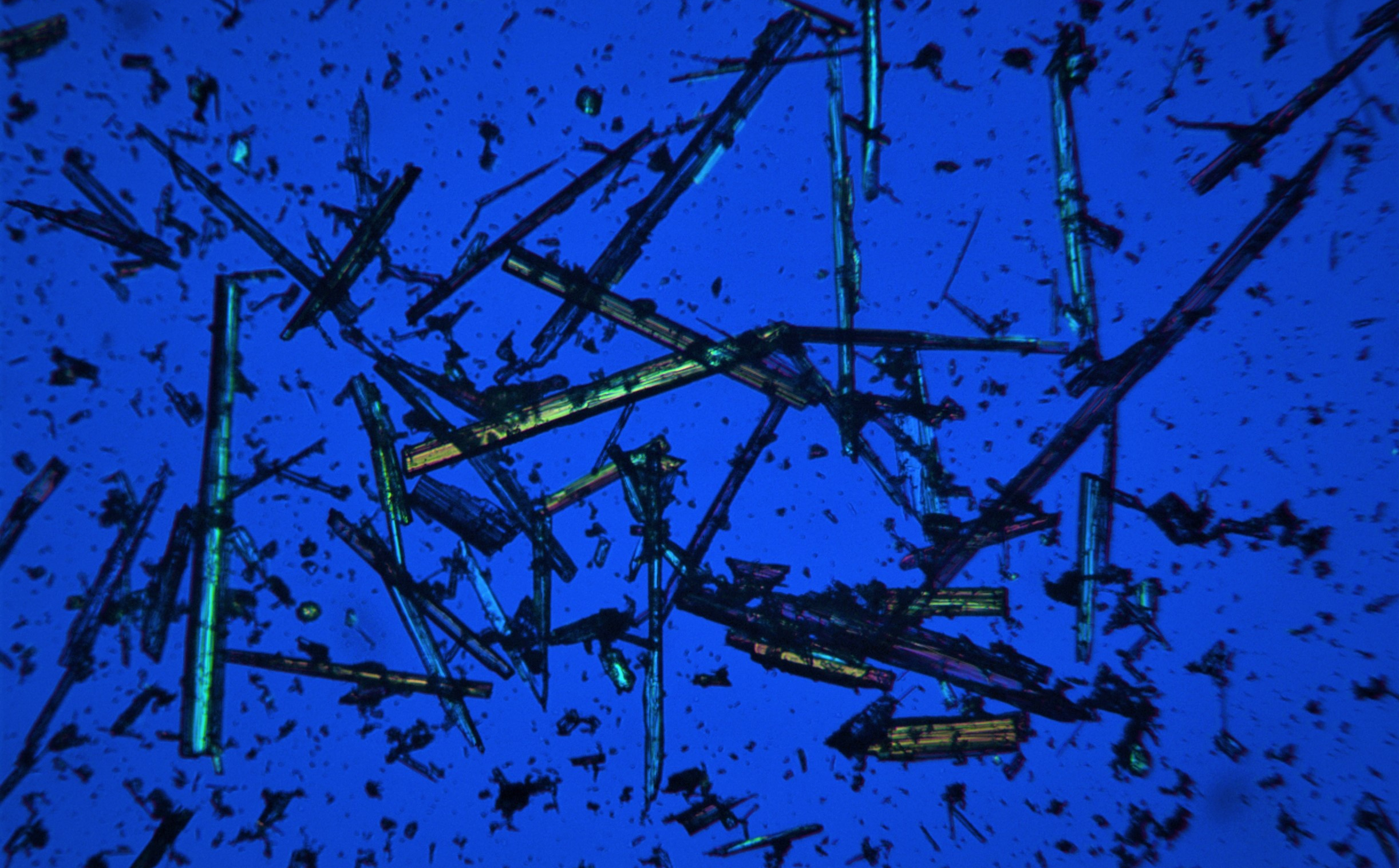 Asbestiform tremolite fibres